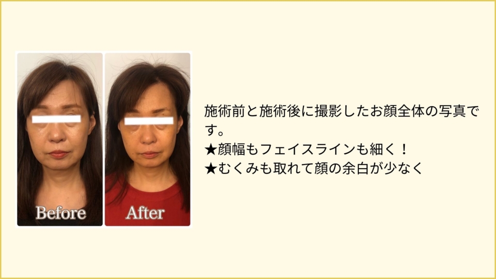 before after 3